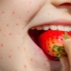 Strawberry Allergy: Causes, Symptoms and Treatment